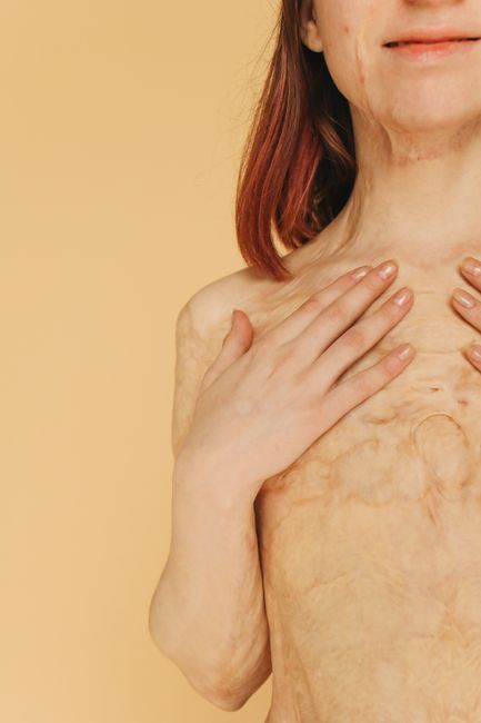 The Body Keeps the Score Review: Lessons on Trauma & Healing