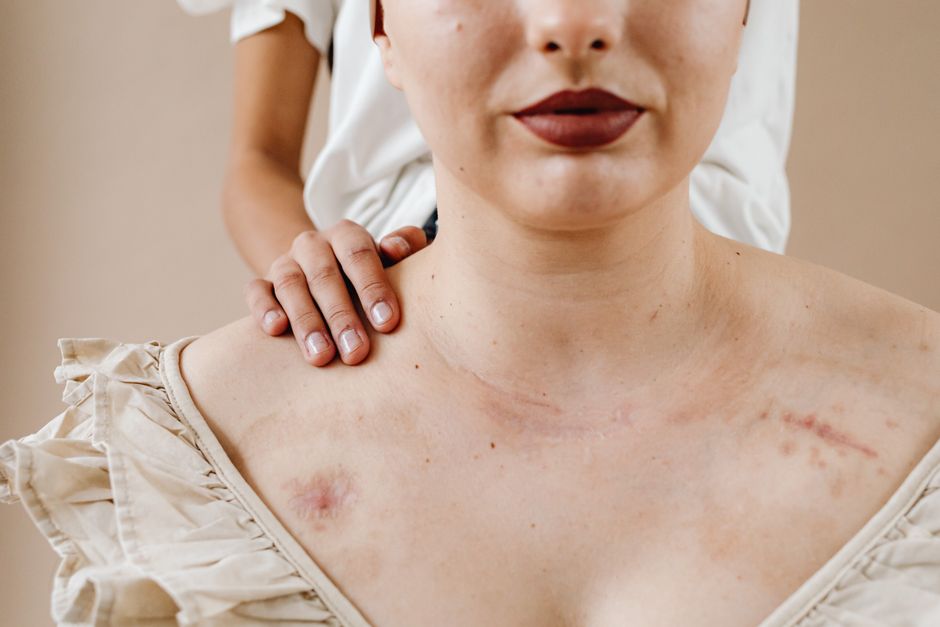 The Body Keeps the Score Review: Lessons on Trauma & Healing